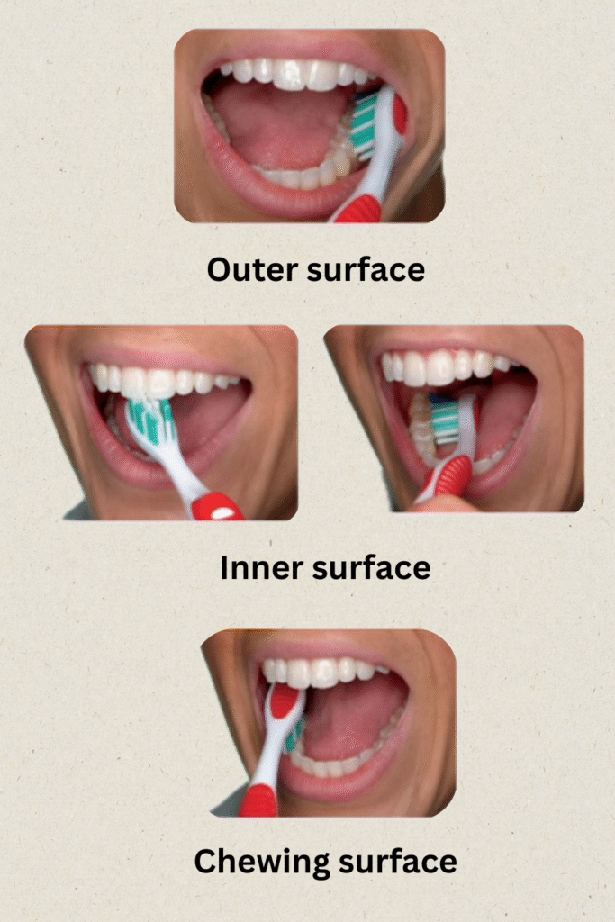 Outer surface